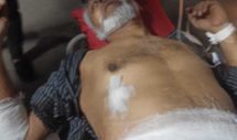 ফতুল্লায় ব্যবসায়ীকে লক্ষ্য করে ৪ রাউন্ড গুলি  ছুড়েন  দুর্বৃত্তরা