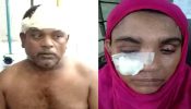 সিদ্ধিরগঞ্জে পানি তোলাকে কেন্দ্র করে  ভাই-ভাবিকে কুপিয়ে জখম