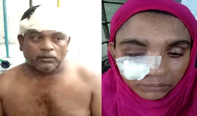 সিদ্ধিরগঞ্জে পানি তোলাকে কেন্দ্র করে  ভাই-ভাবিকে কুপিয়ে জখম