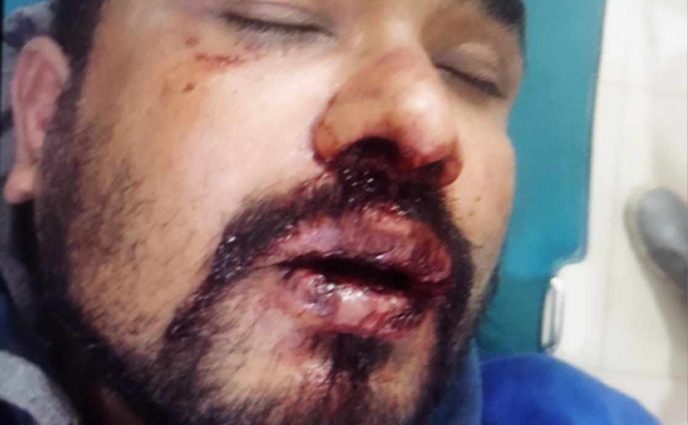 বন্দরে অপহরণের পর যুবককে নির্যাতন, মুক্তিপণ আদায়,থানায় অভিযোগ,পুলিশ বলছে ‘জানা নেই