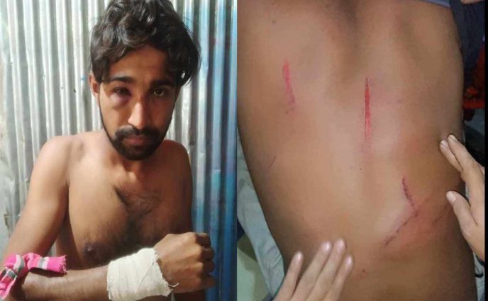 বন্দরে দু’সহোদরকে দু’দফা কুপিয়ে জখম