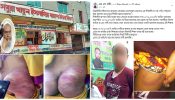সিদ্ধিরগঞ্জে মাদ্রাসায় ২ ছাত্রকে পিটিয়ে জখম