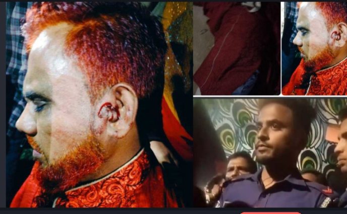 সোনারগাঁয়ে পুলিশ আনসার যৌথ ভাবে যুবলীগ নেতা কে  পিটিয়ে  আহত