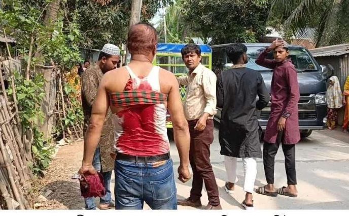রূপগঞ্জে পুলিশের উপস্থিতিতেই সাংবাদিকসহ মুসুল্লিদের উপর হামলায় আহত ১২ – গ্রেফতার ২