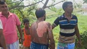 রূপগঞ্জে স্ত্রীর ছোড়া গরম ভাতের ফ্যানে  দগ্ধ স্বামী