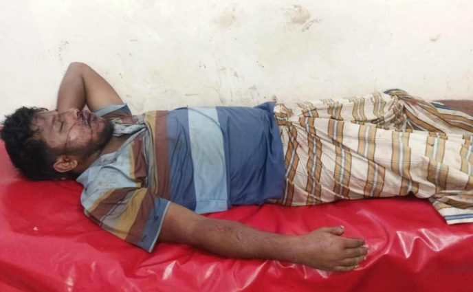 সোনারগাঁওয়ে  মাদক সেবনে বাঁধা দেওয়ায় হামলা : আহত  ১