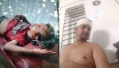 রূপগঞ্জে জোর পূর্বক বসত বাড়ি দখলে বাধা দেওয়ায় কুপিয়ে আহত করার অভিযোগ