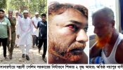 সোনারগাঁয়ে সন্ত্রাসী সেলিম সরকারের নির্যাতনে শিকার ২ বৃদ্ধ আহত; অতিষ্ঠ নয়াপুর বাসী