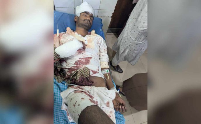 মসজিদের সভাপতির পদ নিয়ে   ছাত্রদল নেতাকে কুপিয়ে জখম