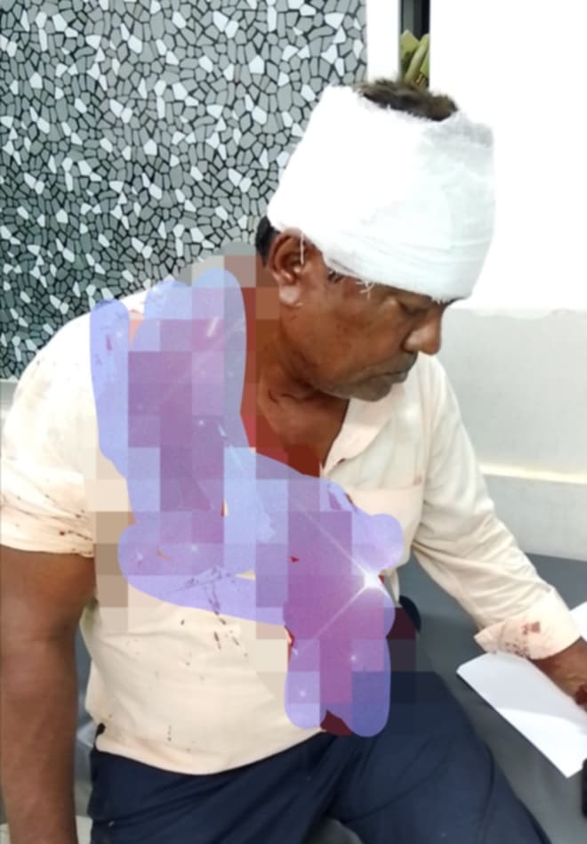 রূপগঞ্জে ইস্ট উড সিটি প্রকল্পে হামলা-ভাঙচুর, প্রজেক্ট ইনচার্জকে কুপিয়ে জখম