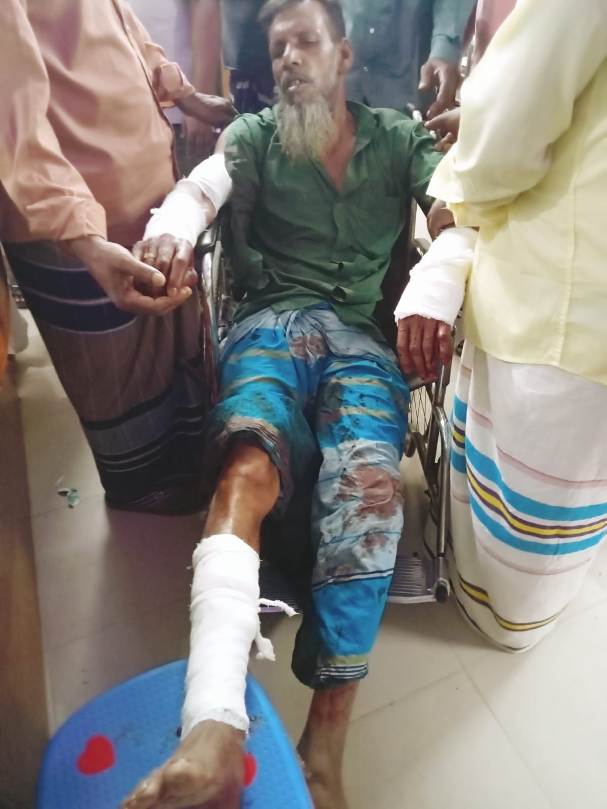 চায়ের দোকানে প্রকাশ্যে চাপাতির কোপ, ঢামেকে মৃত্যুর সঙ্গে পাঞ্জা লড়ছেন বাবুল মোল্লা